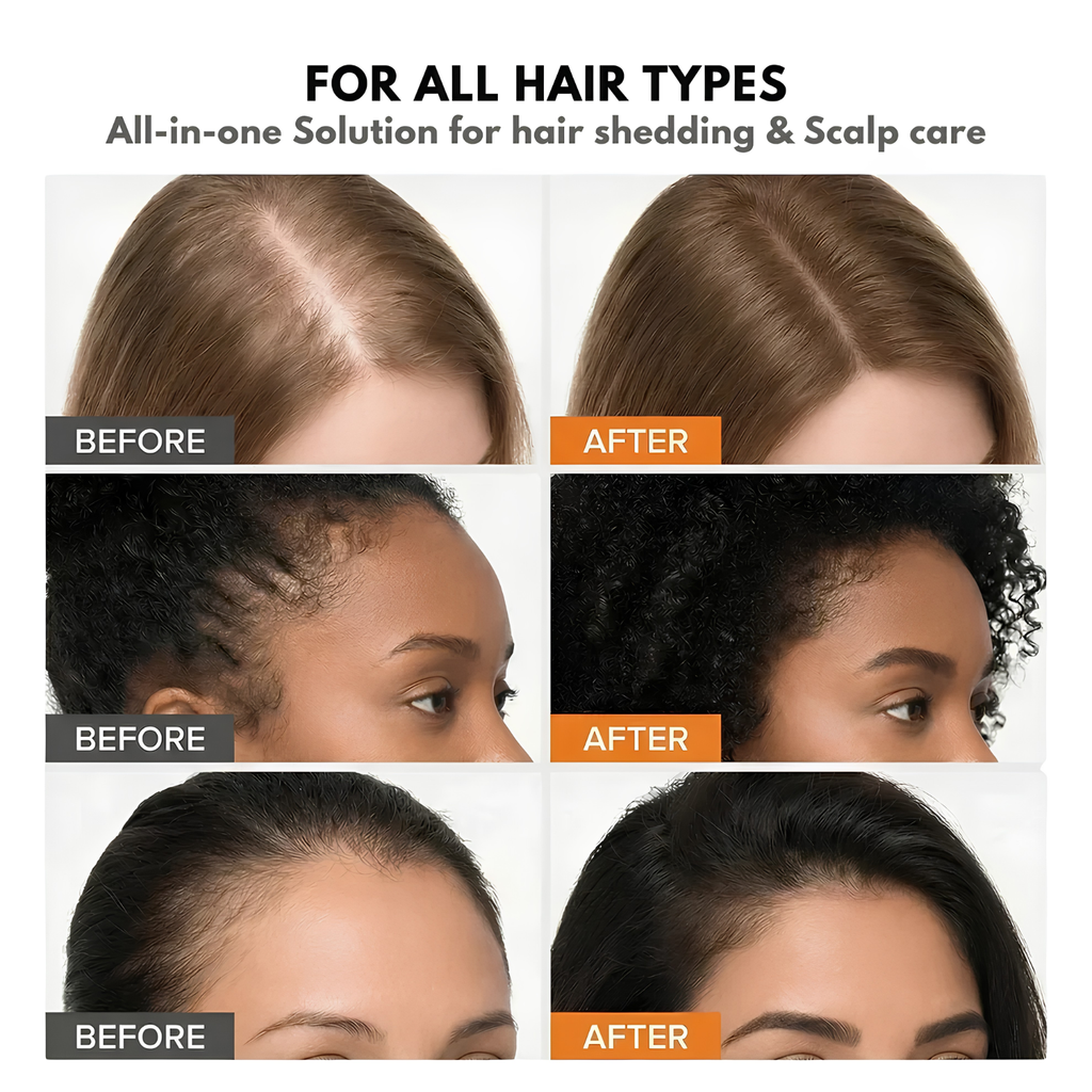 Korea's #1 Hair Growth Serum